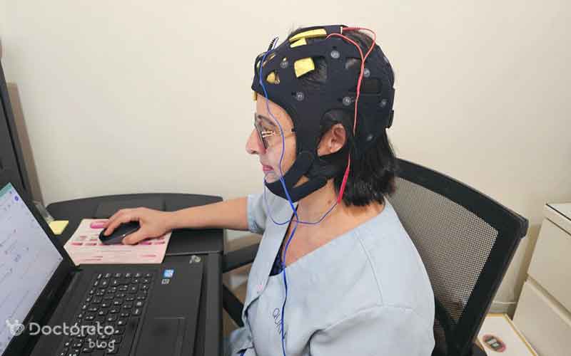 نحوه انجام تحریک الکتریکی مغز tdcs
