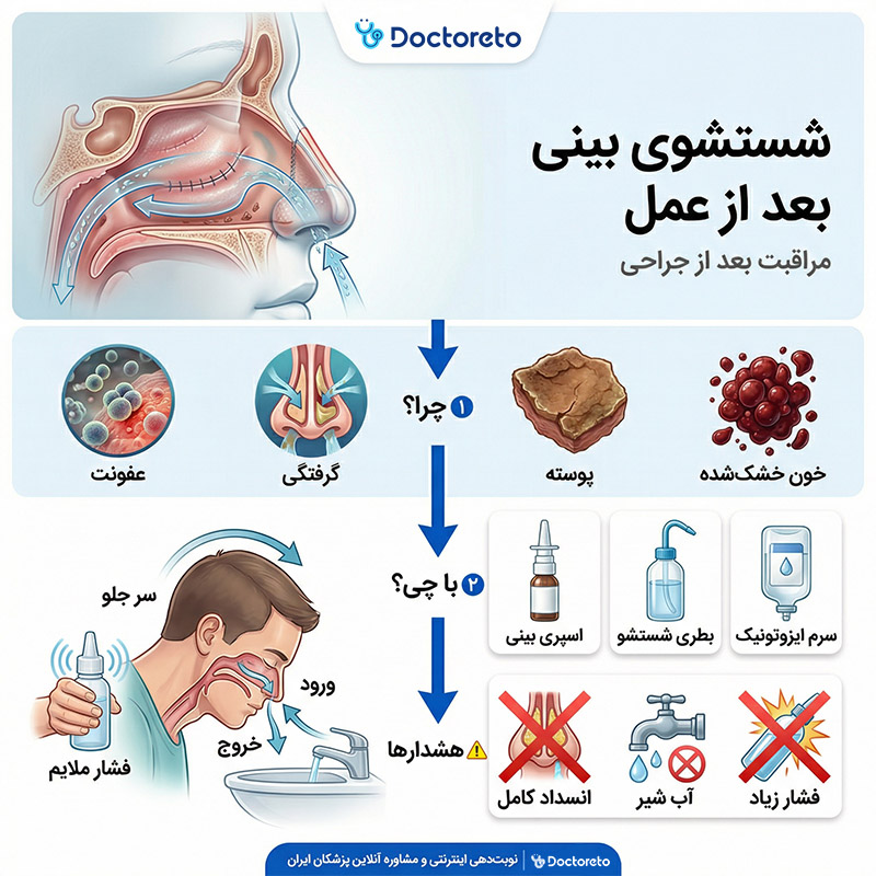 اینفوگرافیک شستشوی بینی بعد از عمل