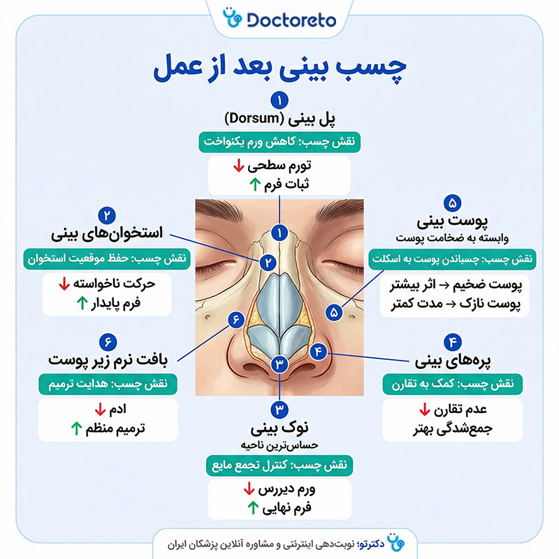 اینفوگرافی چسب بینی بعد عمل بینی