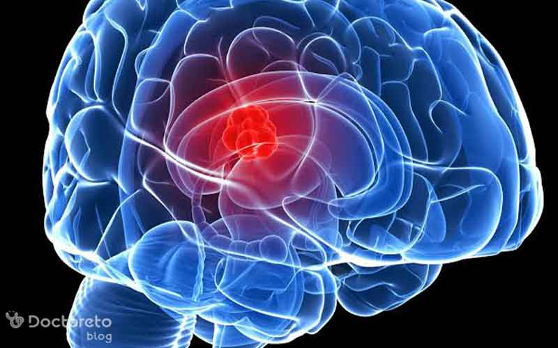 سیستم عصبی چیست؟