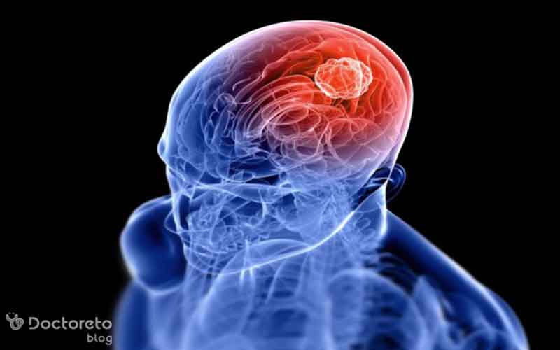 سیستم عصبی چگونه کار می‌ کند؟