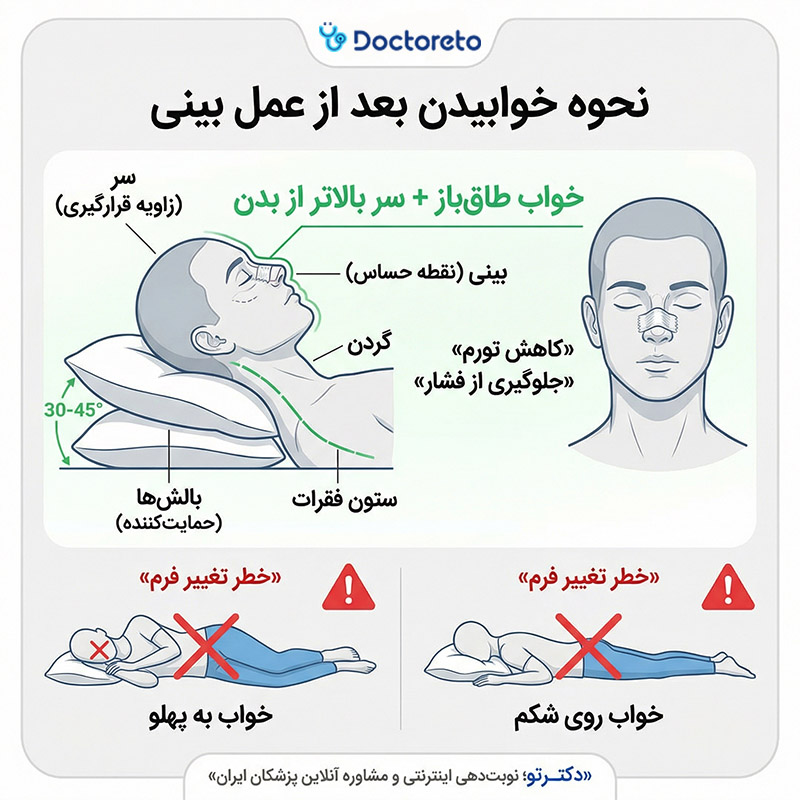 اینفوگرافی نحوه خوابیدن بعد عمل بینی