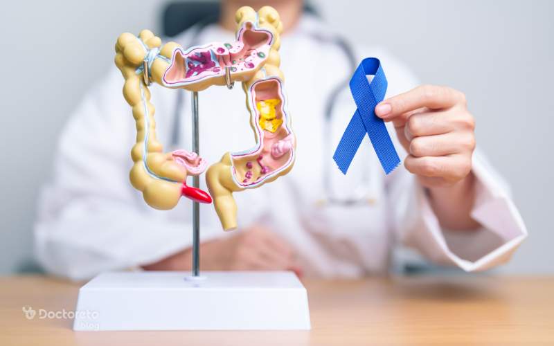 سن ابتلا به سرطان روده چقدر است؟