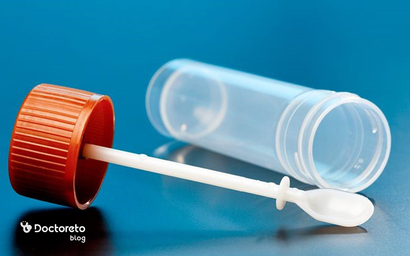 تشخیص سرطان روده با آزمایش مدفوع چگونه است؟