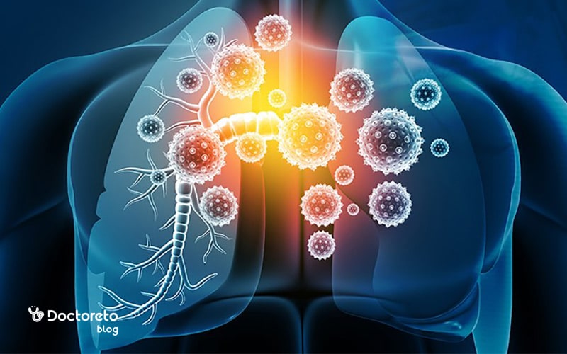 عفونت شدید و گسترش یافته ریه می تواند خطر مرگ را افزایش دهد.