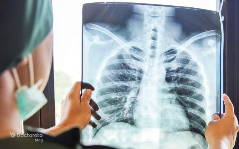 درمان سریع عفونت ریه چیست؟