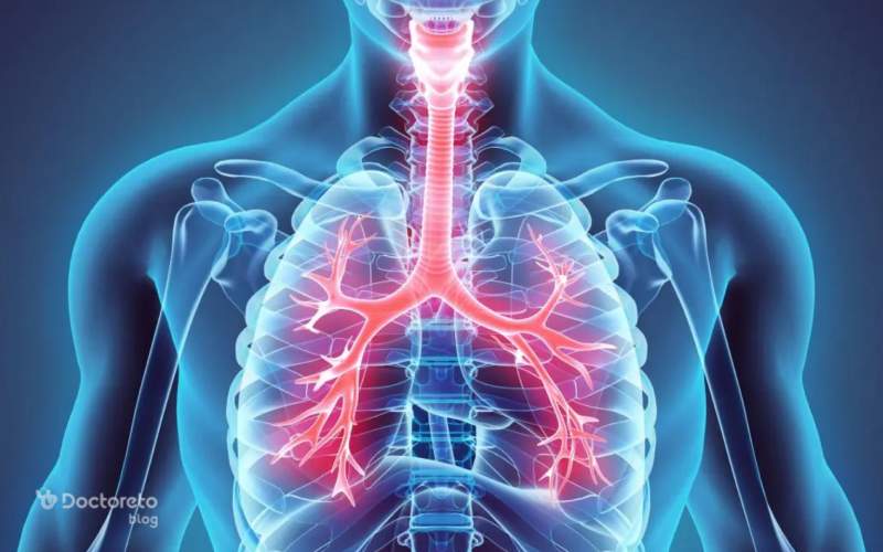 درمان عفونت ریه در خانه چیست؟