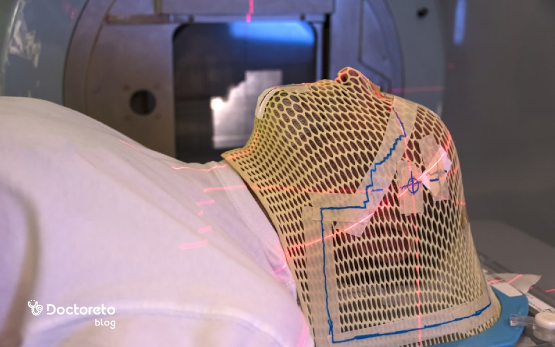 درمان سرطان مغز با پرتوتراپی چگونه است؟