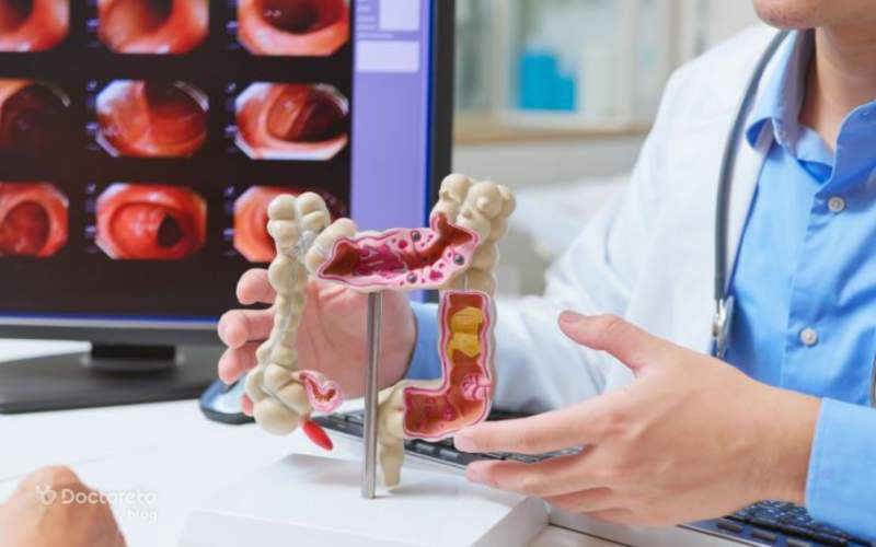 روش های تشخیص خون در مدفوع مربوط به سرطان روده چیست؟