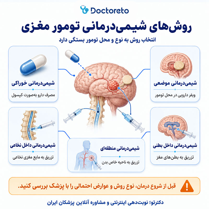 اینفوگرافیک شیمی درمانی تومور مغزی
