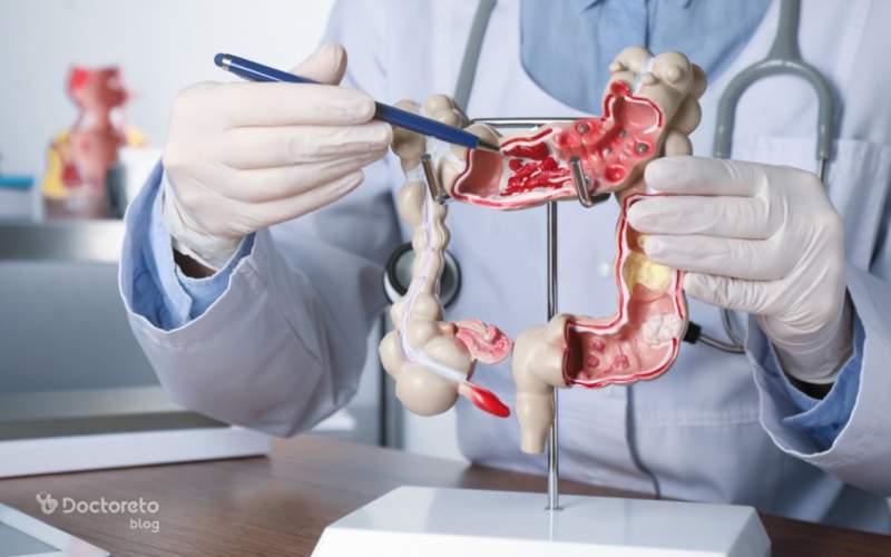 علت سرطان روده بزرگ چیست؟