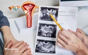 بررسی عوارض برداشتن رحم
