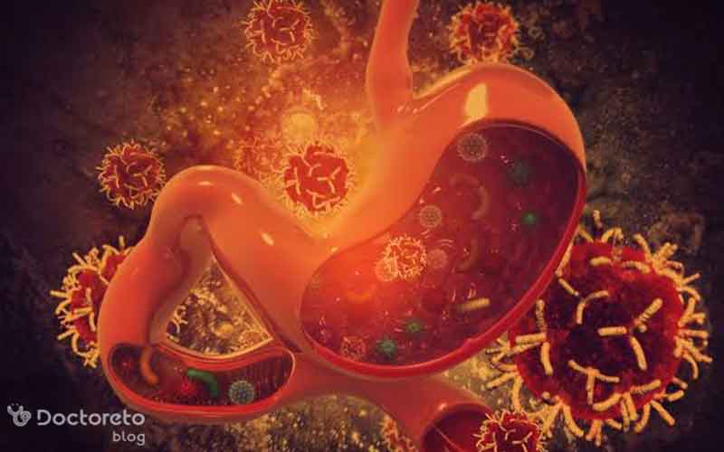 چقدر با سرطان معده بدخیم آشنا هستید؟