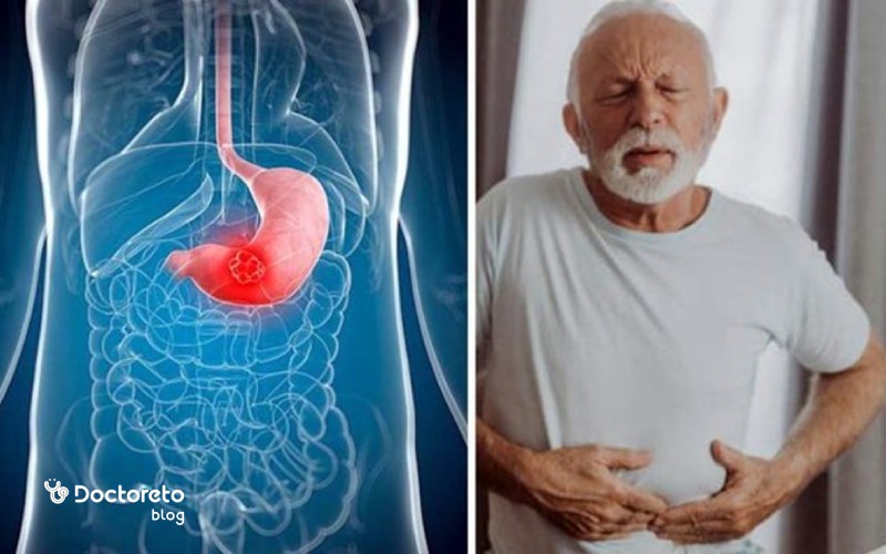 نقش سن در خطر ابتلا به سرطان معده چگونه است؟