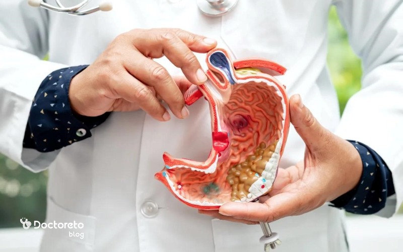 طول عمر بیماران بعد از جراحی در مراحل اولیه سرطان معده چقدر تغییر می کند؟