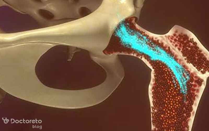 قرص سرطان مغز استخوان چند نوع است؟