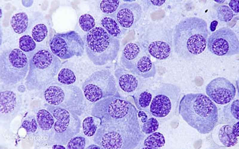 ونتوکلکس یکی از داروهای موثر در درمان سرطان مغز استخوان است.