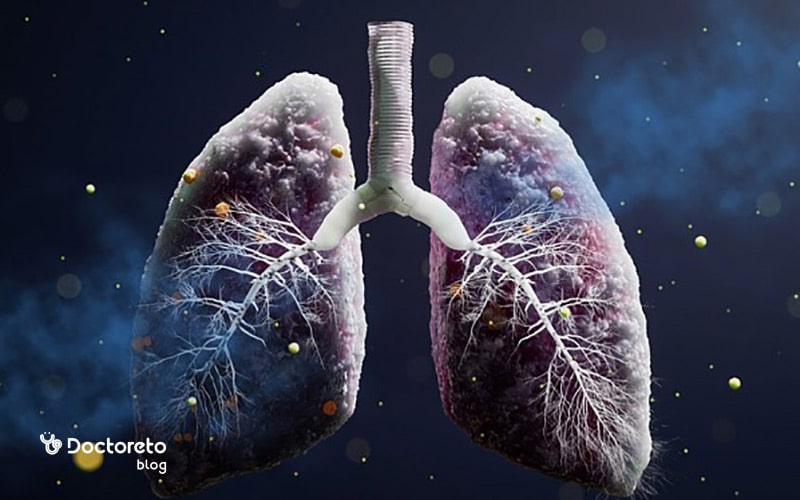 علائم عفونت ریه چیست؟