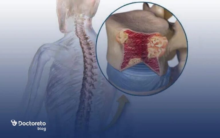 هر آنچه باید درباره سرطان مغز استخوان بدخیم بدانید