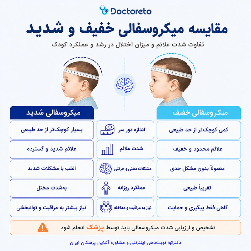 اینفوگرافیک میکروسفالی خفیف