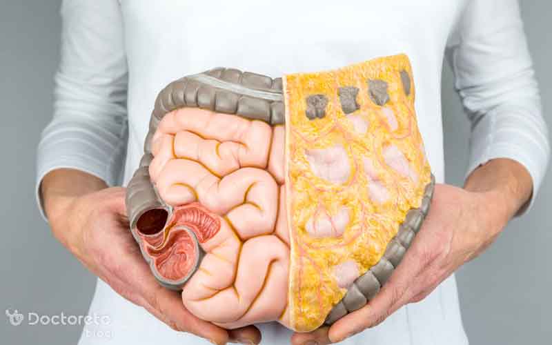 گاز روده و سرطان چه ارتباطی با یکدیگر دارند؟