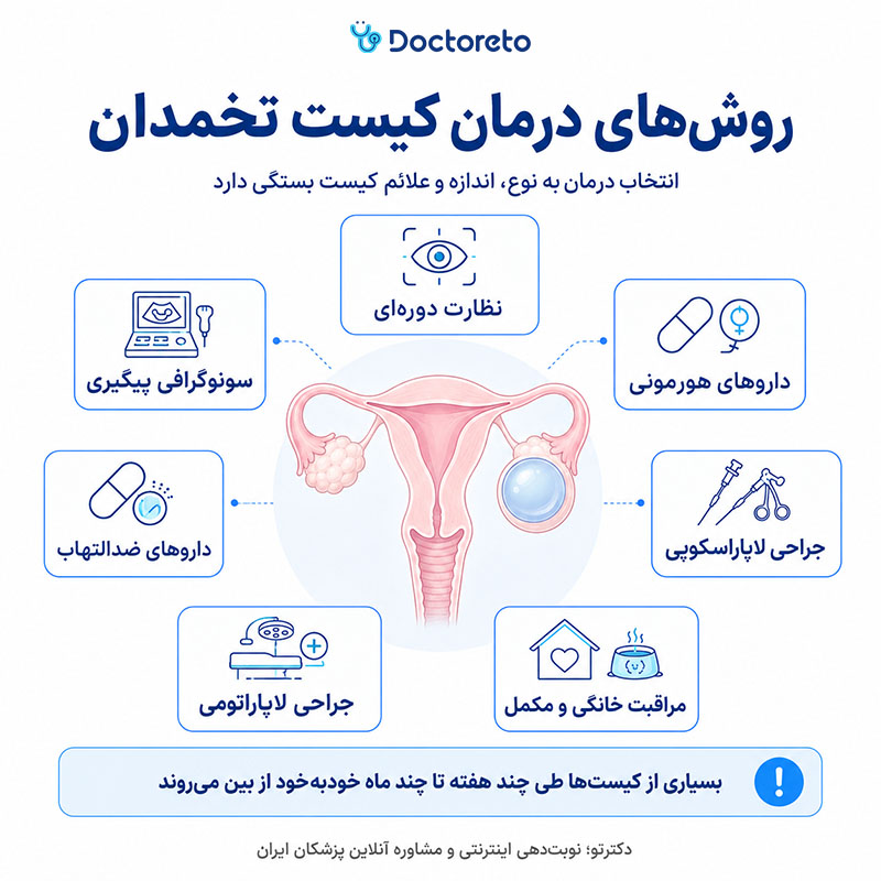اینفوگرافی درمان کیست تخمدان