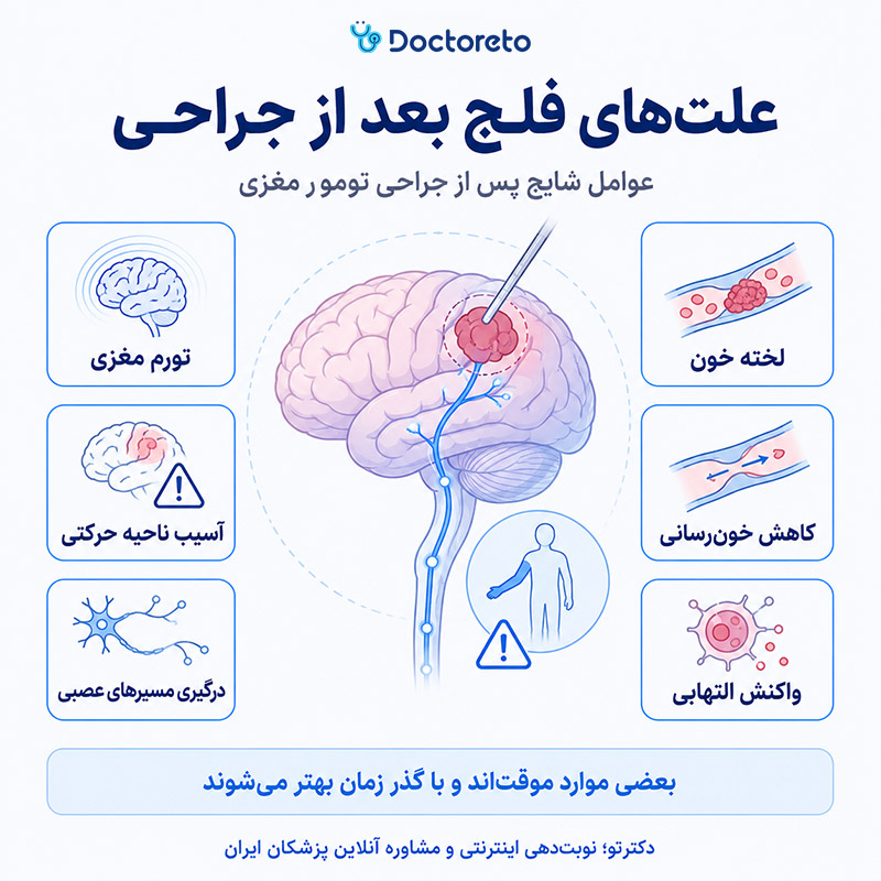 اینفوگرافی فلج شدن بعد از عمل تومور مغزی