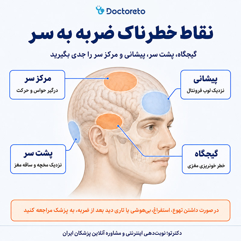 اینفوگرافی ضربه به کدام قسمت سر خطرناکه