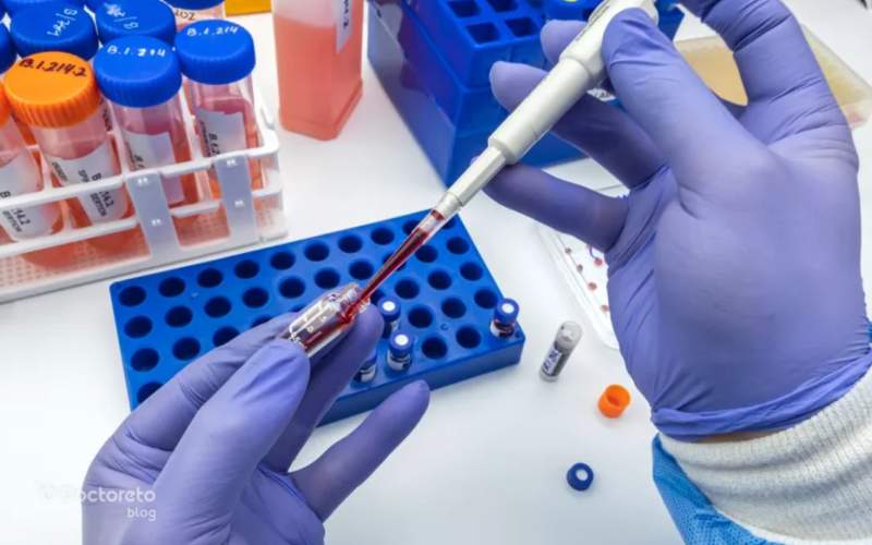 علائم سرطان روده در آزمایش خون چیست؟