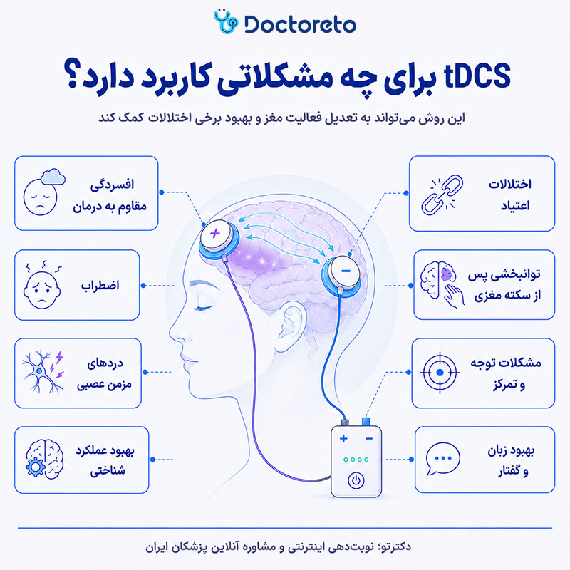 اینفوگرافیک تحریک الکتریکی مغز tdcs 