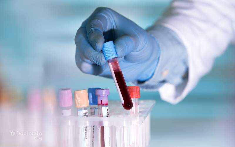 رعایت نکات مهم قبل و بعد آزمایش یائسگی ضروری است.