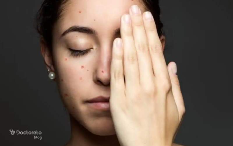 جای ابله مرغان چقدر باقی می ماند؟