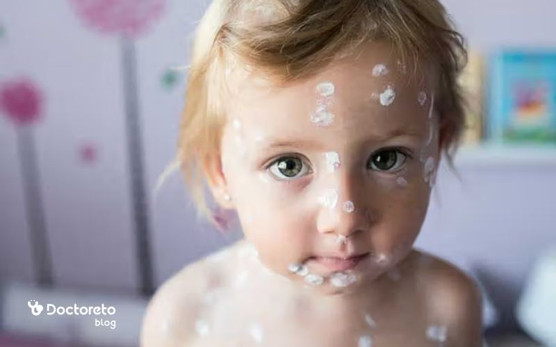 آیا مصرف نوشیدنی های شیرین و گازدار برای مبتلایان به آبله مرغان مضر است؟