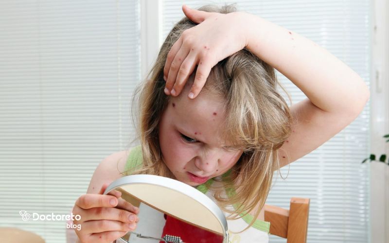 آیا واکسیناسیون میتواند از شیوع فصلی آبله مرغان جلوگیری کند؟