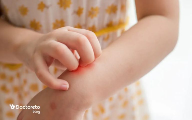 تفاوت ابله مرغان با حساسیت چیست؟