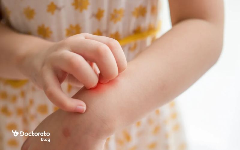 مدت زمان ماندگاری جوش ها در آبله مرغان با جوش های ناشی از حساسیت چقدر تفاوت دارد؟