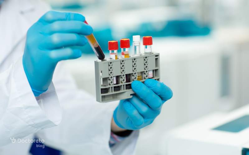 آزمایش cpk چه زمانی انجام میشود؟