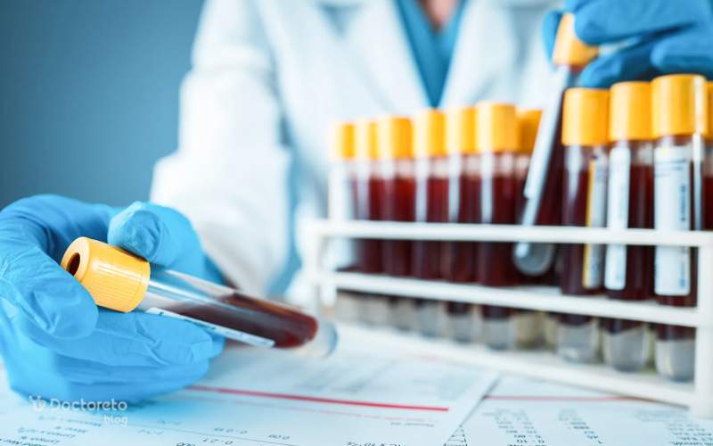 آزمایش cpk چیست؟