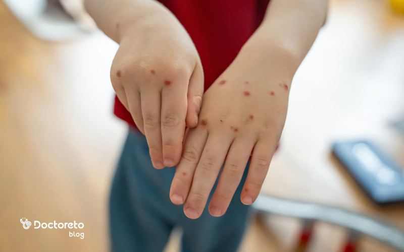 علائم انتقال تب برفکی به انسان کی مشخص میشود؟