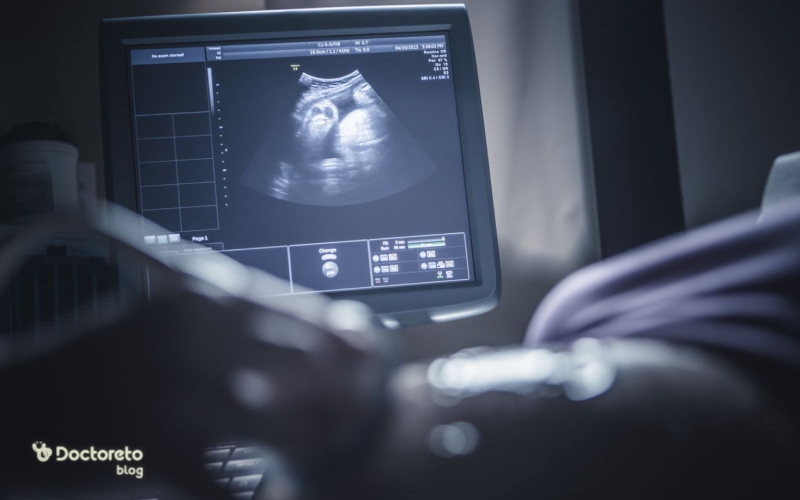 سونوگرافی برای تشخیص علاؤم جنین مرده در شکم