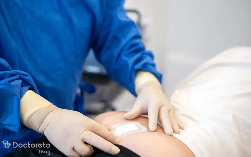 درمان فیستول مویی با سیر موثر است؟