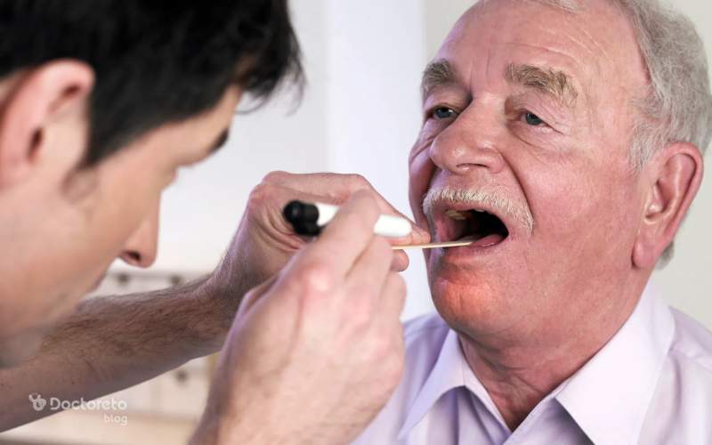 احتمال زنده ماندن در سرطان لوزه چقدر است؟