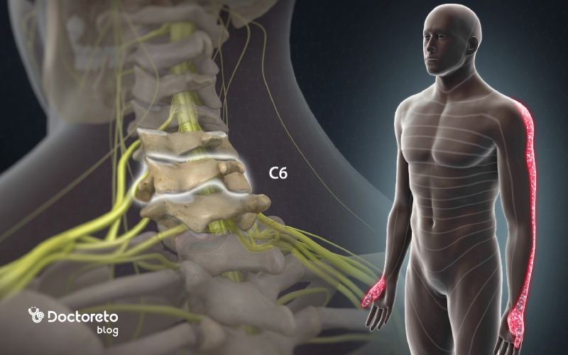 درمان بی حسی دست راست ناشی از مشکلات گردن و دیسک گردنی چیست؟