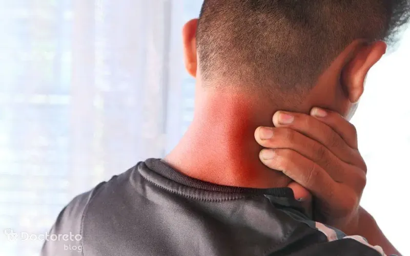 کدام دارو برای کیست گردن موثر است؟