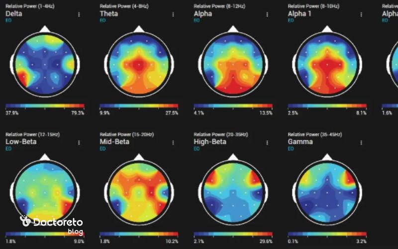 بخش سیگنال خام EEG و نمودار امواج مغزی چگونه تفسیر می شود؟
