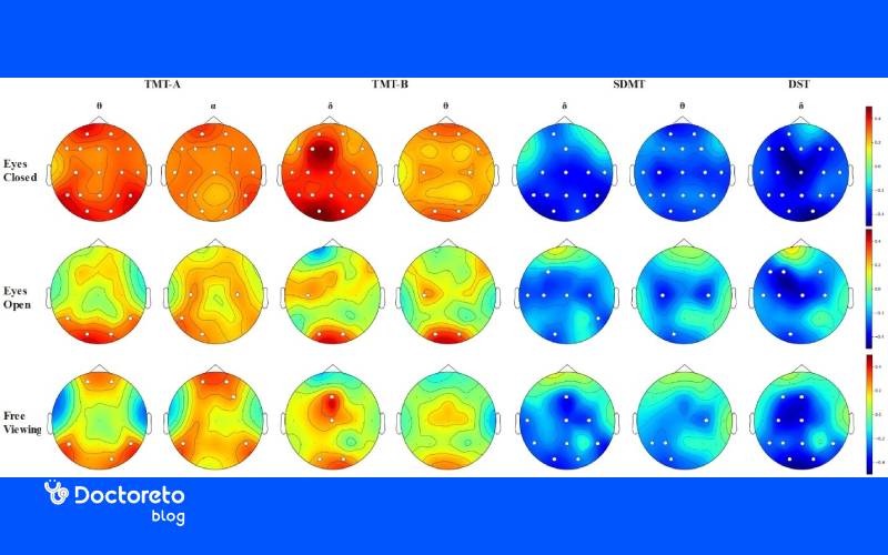 الگوهای شایع امواج مغزی در افراد دوقطبی چگونه هستند؟