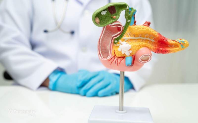 پانکراس چیست؟