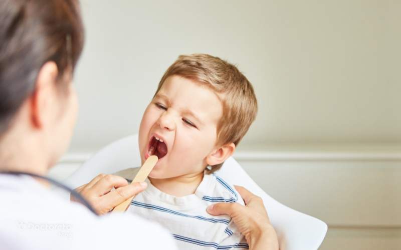 درمان سنگ لوزه در کودکان چگونه است؟