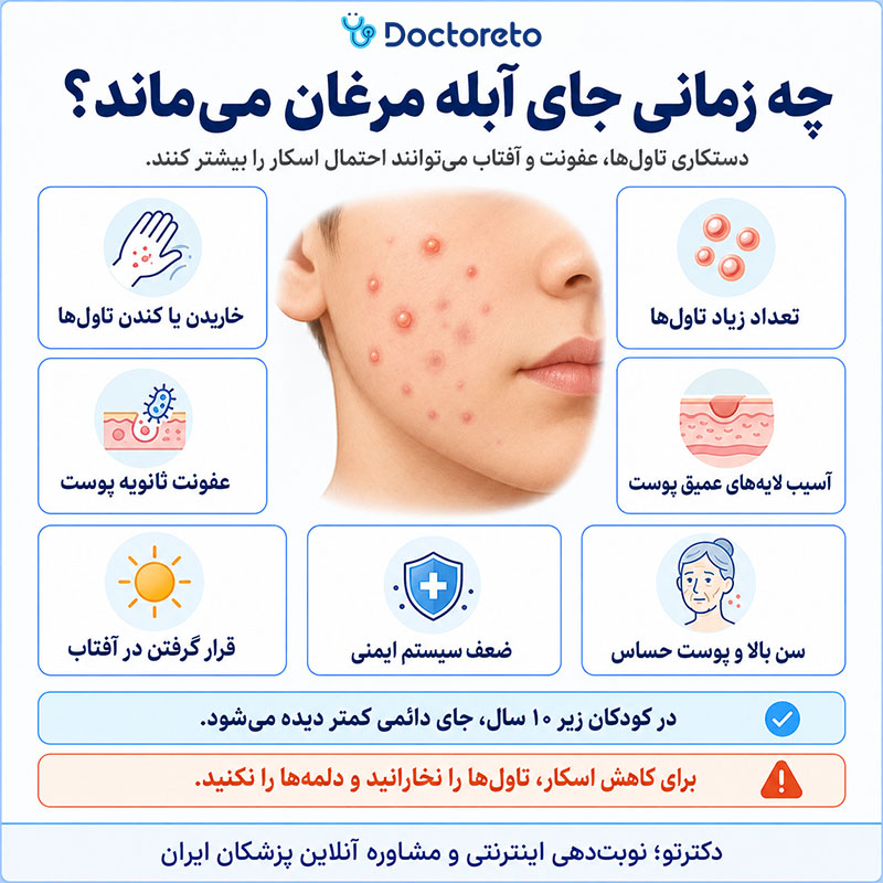 اینفوگرافی در چه صورت جای آبله مرغان می ماند
