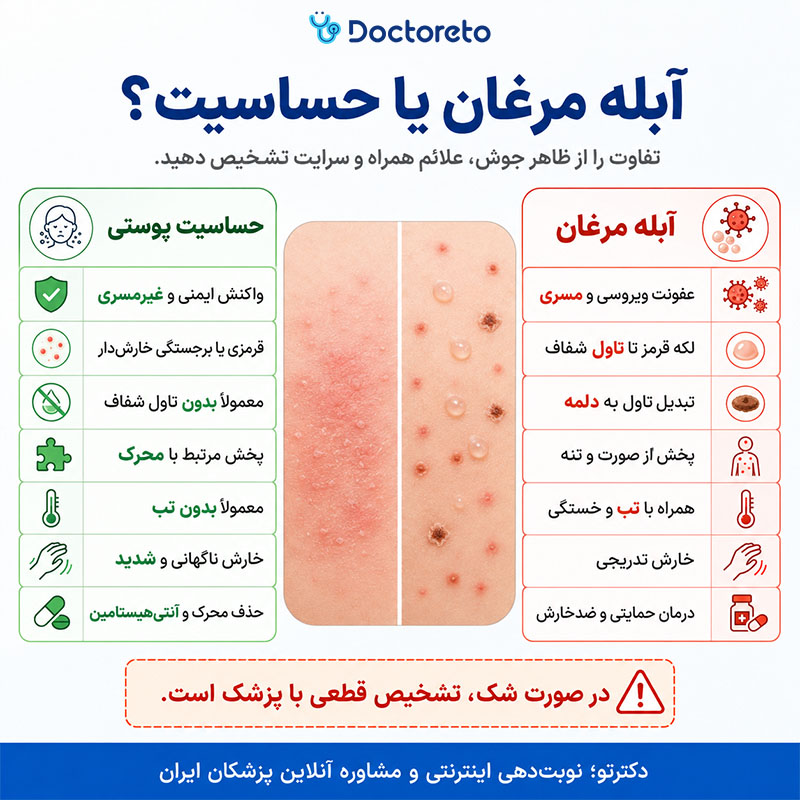 اینفوگرافی تفاوت ابله مرغان با حساسیت